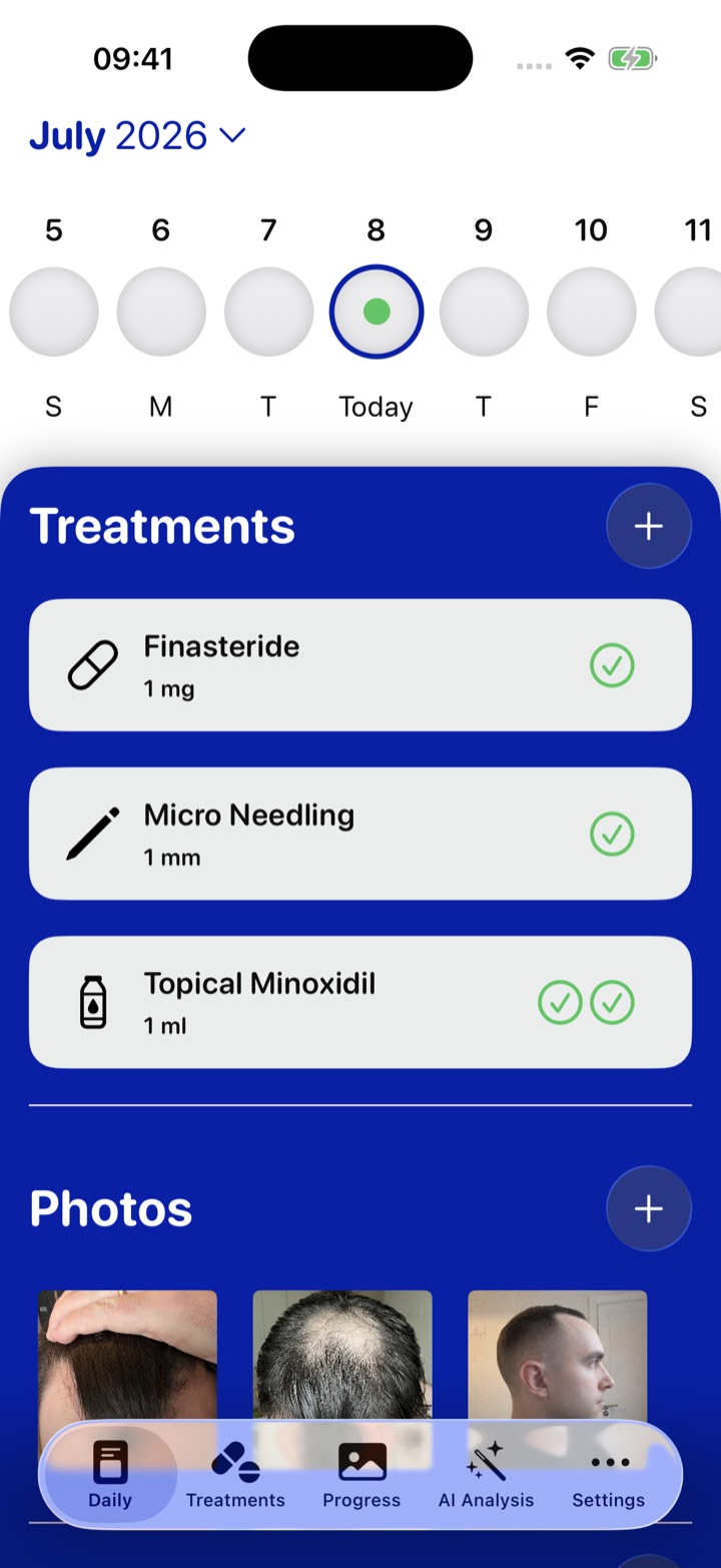 Track Hair daily view showing today's finasteride, minoxidil, and microneedling marked complete